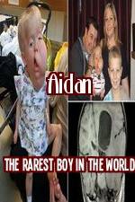 Watch Aidan The Rarest Boy In The World Viooz