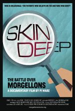 Watch Skin Deep: The Battle Over Morgellons Viooz