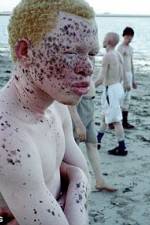 Watch Albino United Viooz