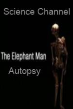 Watch Science Channel Elephant Man Autopsy Viooz