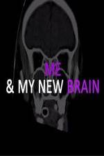 Watch Me & My New Brain Viooz