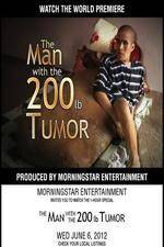 Watch The Man With The 200lb Tumor Viooz