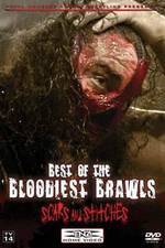 Watch TNA Wrestling: Best of the Bloodiest Brawls - Scars and Stitches Viooz