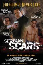 Watch Serbian Scars Viooz
