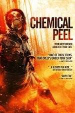 Watch Chemical Peel Viooz
