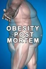 Watch Obesity: The Post Mortem Viooz