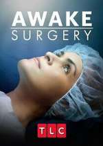 Watch Awake Surgery Viooz
